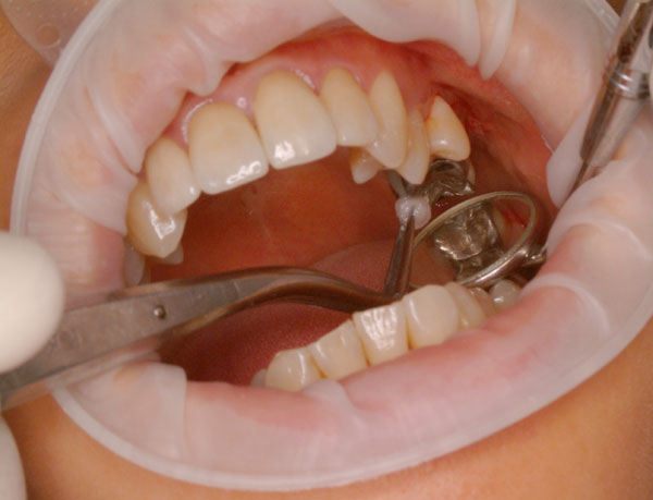 Jak pielęgnować zęby