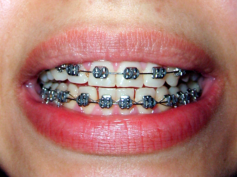 images/ortodonta.jpg1bc42.jpg